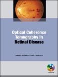 Optical Coherence Tomography. Text with DVD