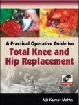 Practical Operative Guide for Total Knee and Hip Replacement. Text with DVD