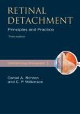 Retinal Detachment: Principles and Practice
