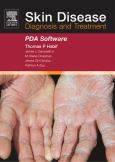 Skin Disease: Diagnosis and Treatment PDA Software on CD-ROM for Palm OS, Windows CE and Pocket PC