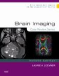Case Review: Brain Imaging