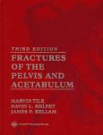 Fractures of the Pelvis and Acetabulum. Text with CD-ROM for Macintosh and Windows