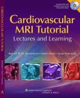 Cardiovascular MRI Tutorial: Lectures and Learning. Text with DVD