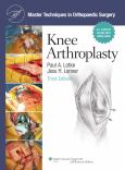 Knee Arthroplasty. Text with Internet Access Code for Integrated Website