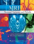 MRI Normal Variants and Pitfalls