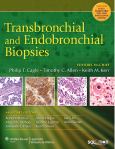 Transbronchial and Endobronchial Biopsies. Text with Internet Access Code for Integrated Website