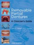 Removable Partial Dentures: A Clinician's Guide