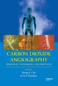 Carbon Dioxide Angiography: Principles, Techniques, and Practices