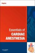 Essentials of Cardiac Anesthesia