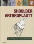 Shoulder Arthroplasty. Text with DVD
