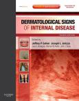 Dermatological Signs of Internal Disease. Text and Internet Access Code for Expert Consult Edition