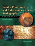 Fundus Fluorescein and Indocyanine Green Angiography: A Textbook and Atlas