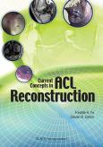 Current Concepts in ACL Reconstruction