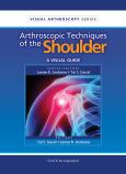 Arthroscopic Techniques of the Shoulder: A Visual Guide