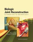 Biologic Joint Reconstruction: Alternatives to Arthroplasty