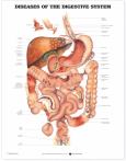 Diseases of the Digestive System. 20X26 Laminated Chart.