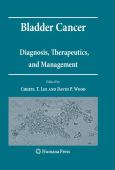 Bladder Cancer: Diagnosis, Therapeutics, and Management