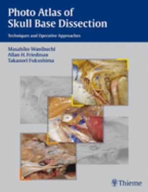 Photo Atlas of Skull Base Dissection: Techniques and Photo Atlas of Skull Base Dissection: Techniques and