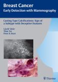 Casting Type Calcifications: Sign of Subtype with Deceptive Features