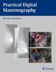 Practical Digital Mammography