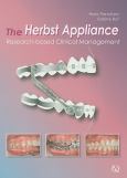 Herbst Appliance: Research-based Clinical Management