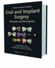 Oral and Implant Surgery: Principles and Procedures