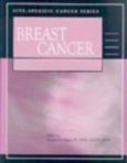 Site-Specific Cancer Series: Breast Cancer