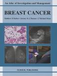 Breast Cancer: An Atlas of Investigation and Management