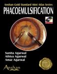 Phacoemulsification. Text with DVD