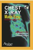 Chest X-Ray Made Easy. Text with mini CD-ROM for Windows