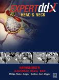 Expert Differential Diagnosis: Head and Neck