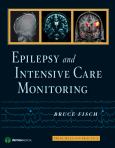 Epilepsy and Intensive Care Monitoring: Principles and Practice