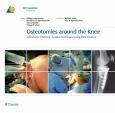 Osteotomies Around the Knee: Indications-Planning-Surgical Techniques Using Plate Fixators