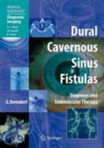 Dural Cavernous Sinus Fistulas: Diagnostic and Endovascular Therapy