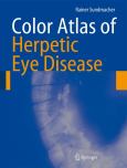 Color Atlas of Herpetic Eye Disease: A Practical Guide to Clinical Management