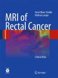 MRI of Rectal Cancer. Text with CD-ROM for Macintosh and Windows
