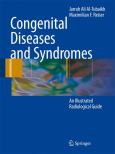 Congenital Diseases and Syndromes: An Illustrated Radiological Guide