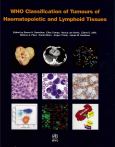 Classification of Tumours of Haematopoietic and Lymphoid Tissues